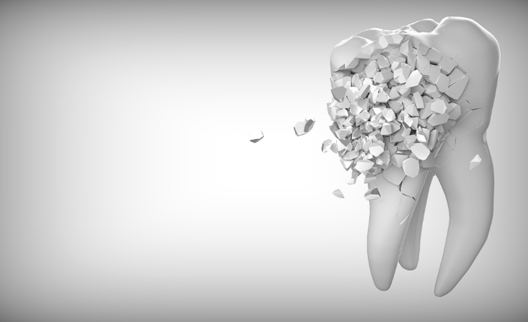 Частые вопросы о зубных протезах