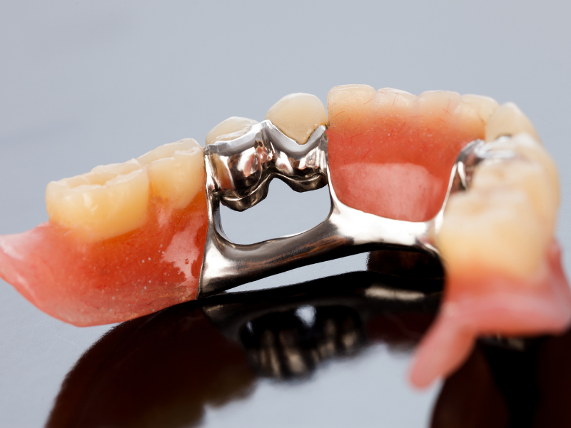 nesyemnie-zubnie-protezi